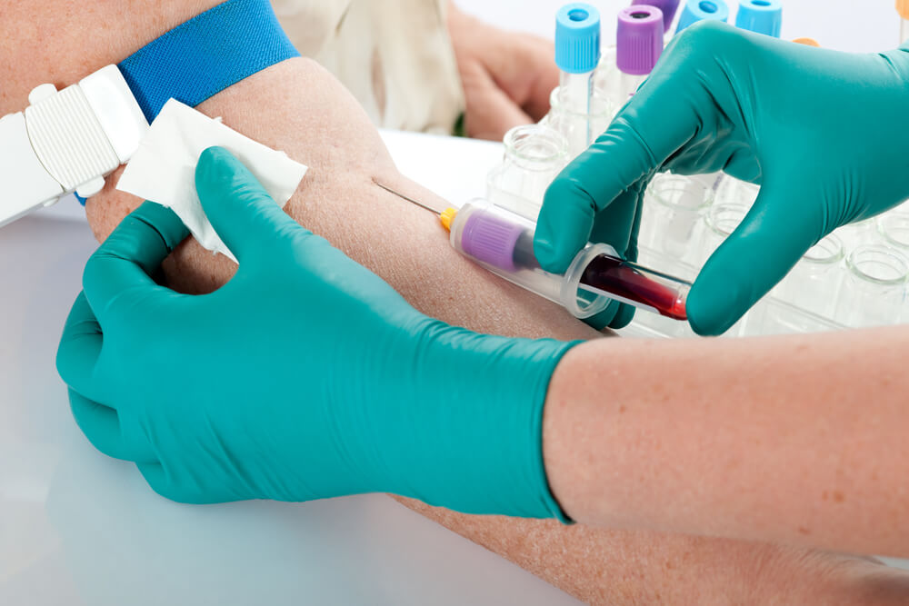 Paverama amplia oferta de exames laboratoriais