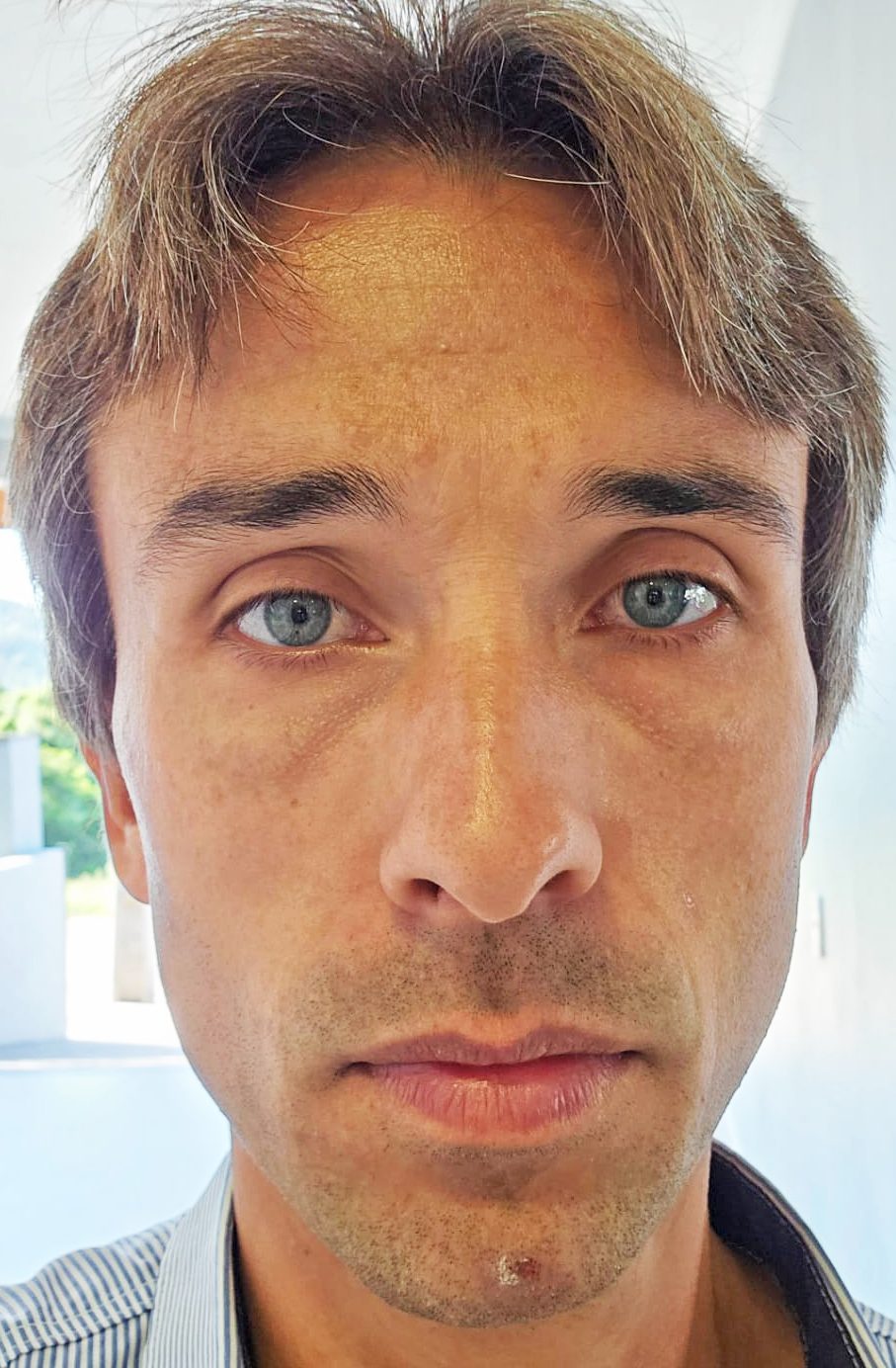 Foto - Frederico Wessel